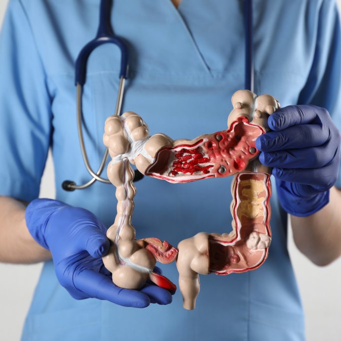 South Florida Gastroenterologist